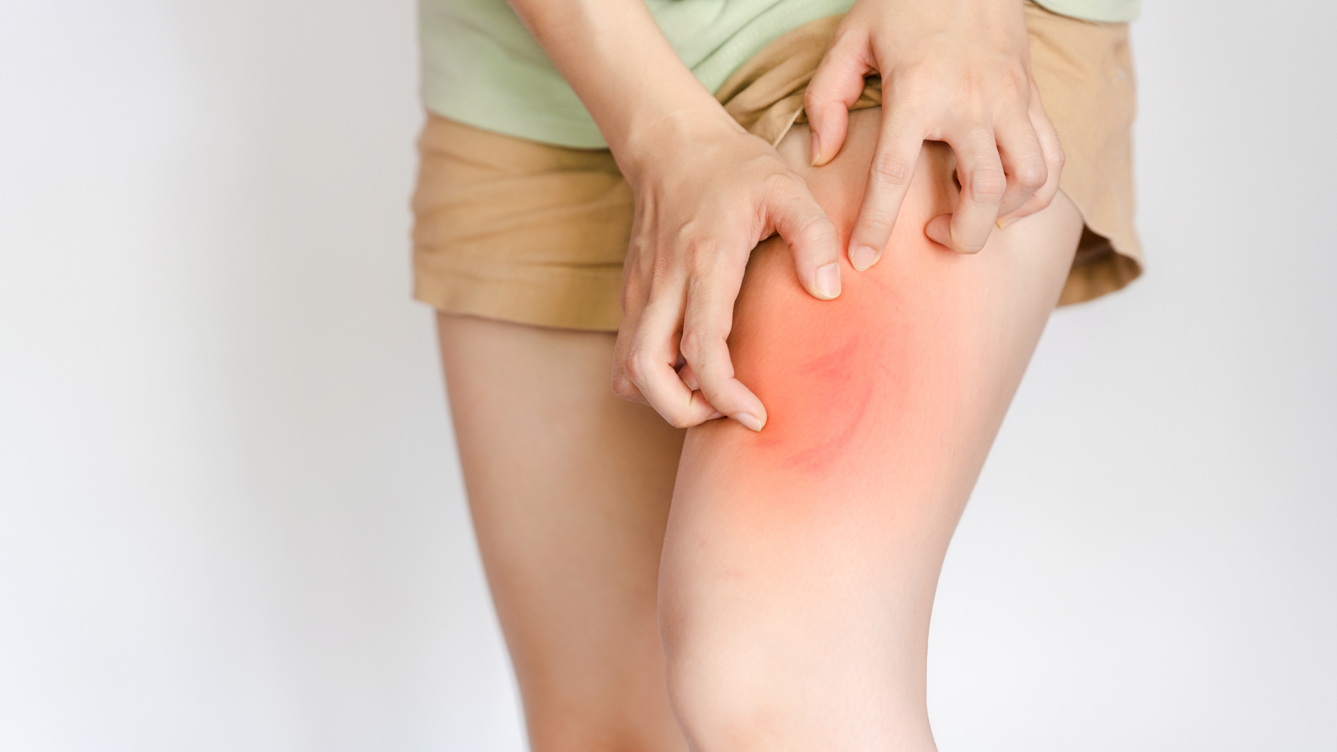 Understanding Side Effects vs. Allergic Reactions: Knowing the Difference Can Protect Your Health