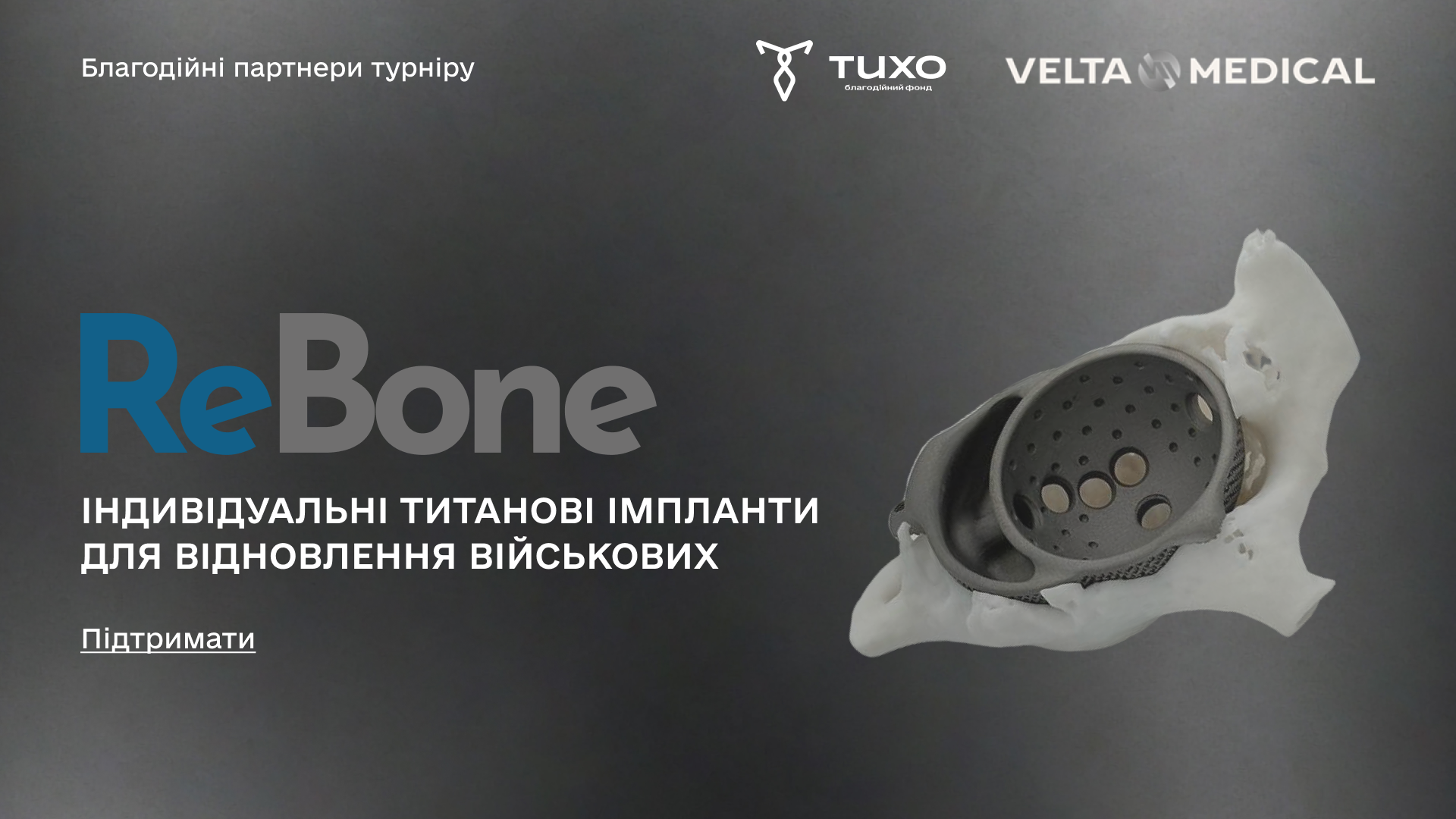 ReBone — сучасні медичні рішення з імплантації для відновлення військових