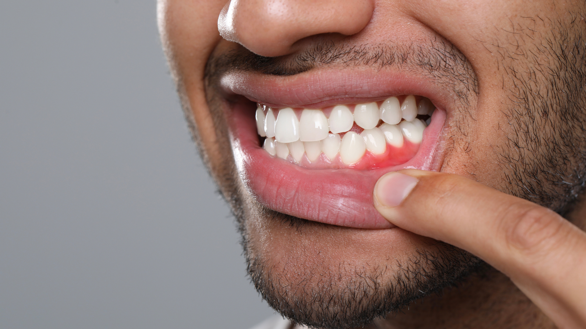Why Do My Gums Bleed When I Brush?