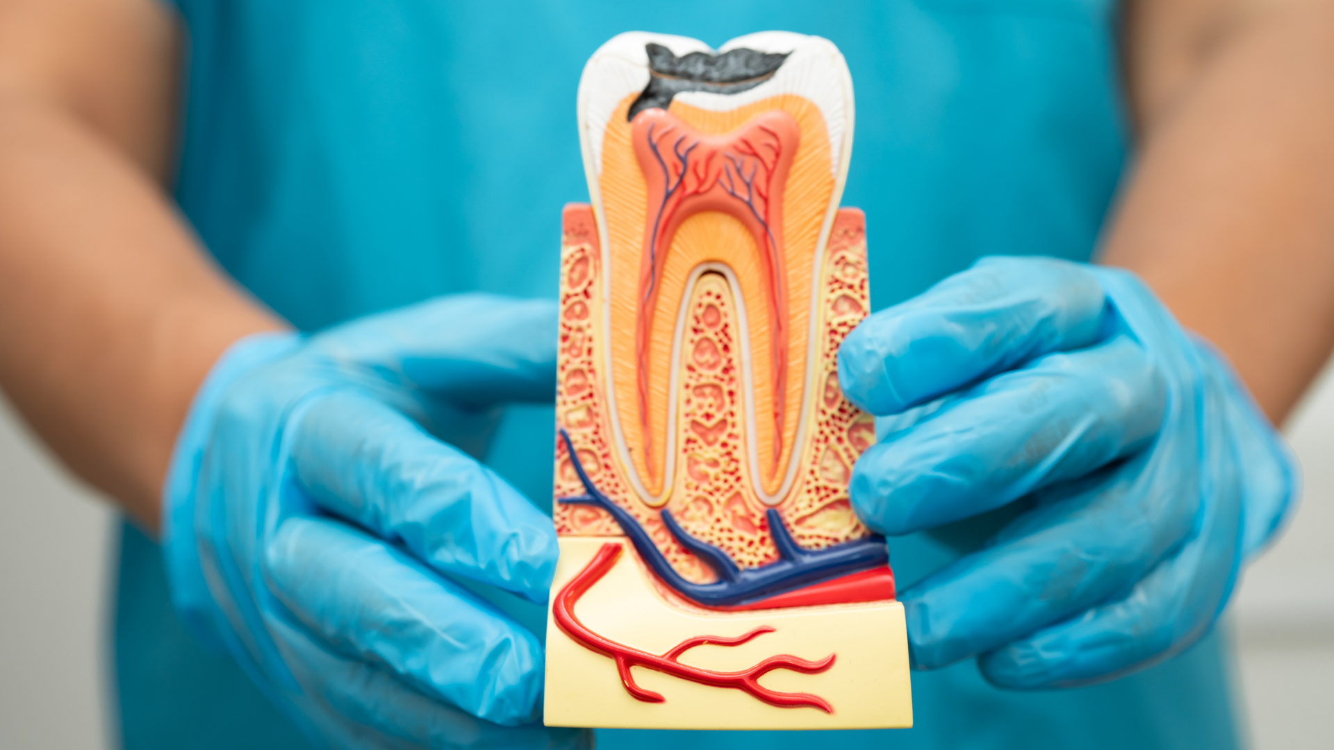 Do I Need a Root Canal? Here’s How to Know