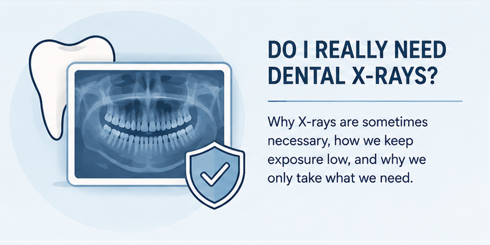 Do I Really Need Dental X-Rays?