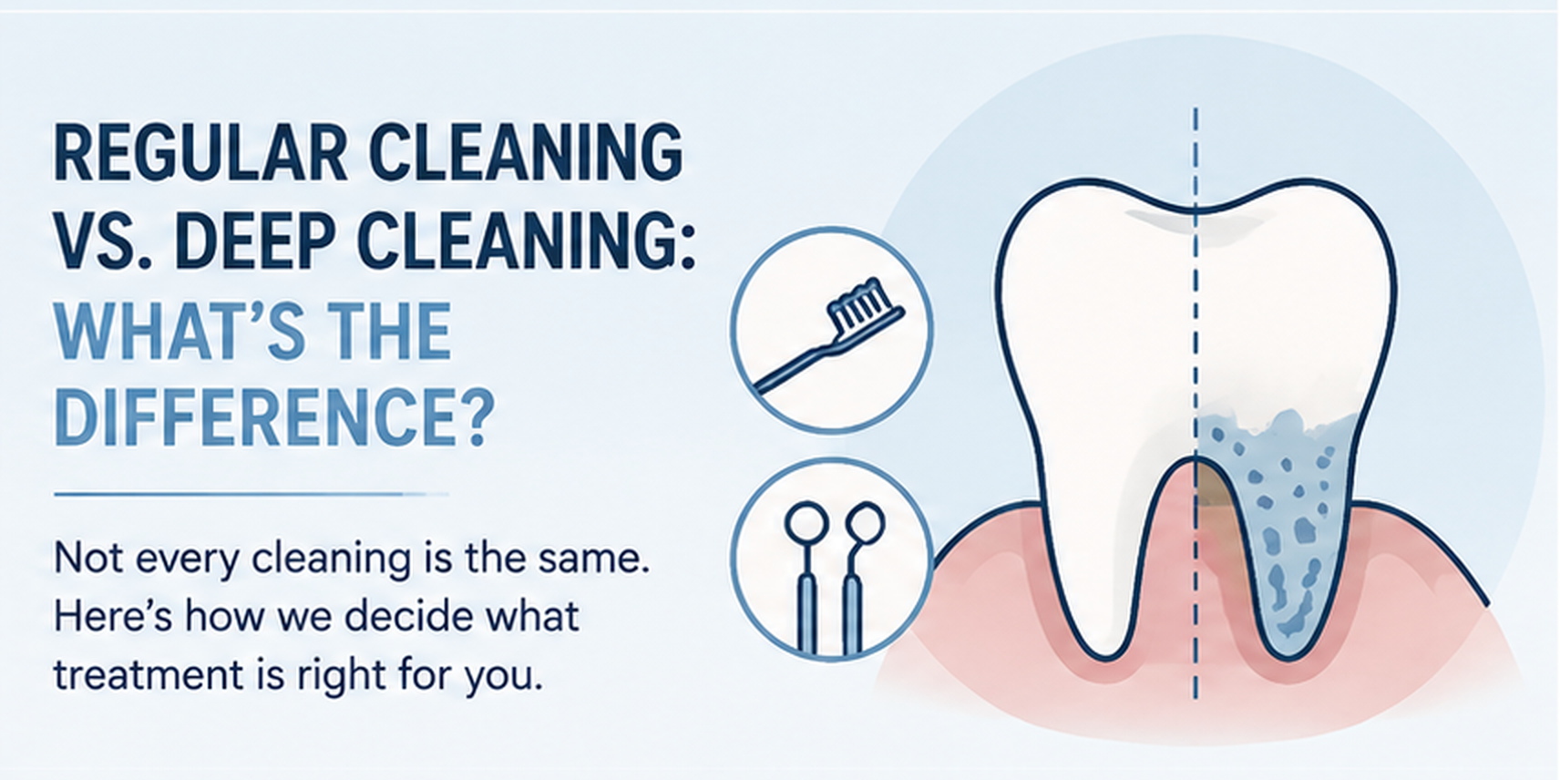 Regular vs. Deep Cleanings.