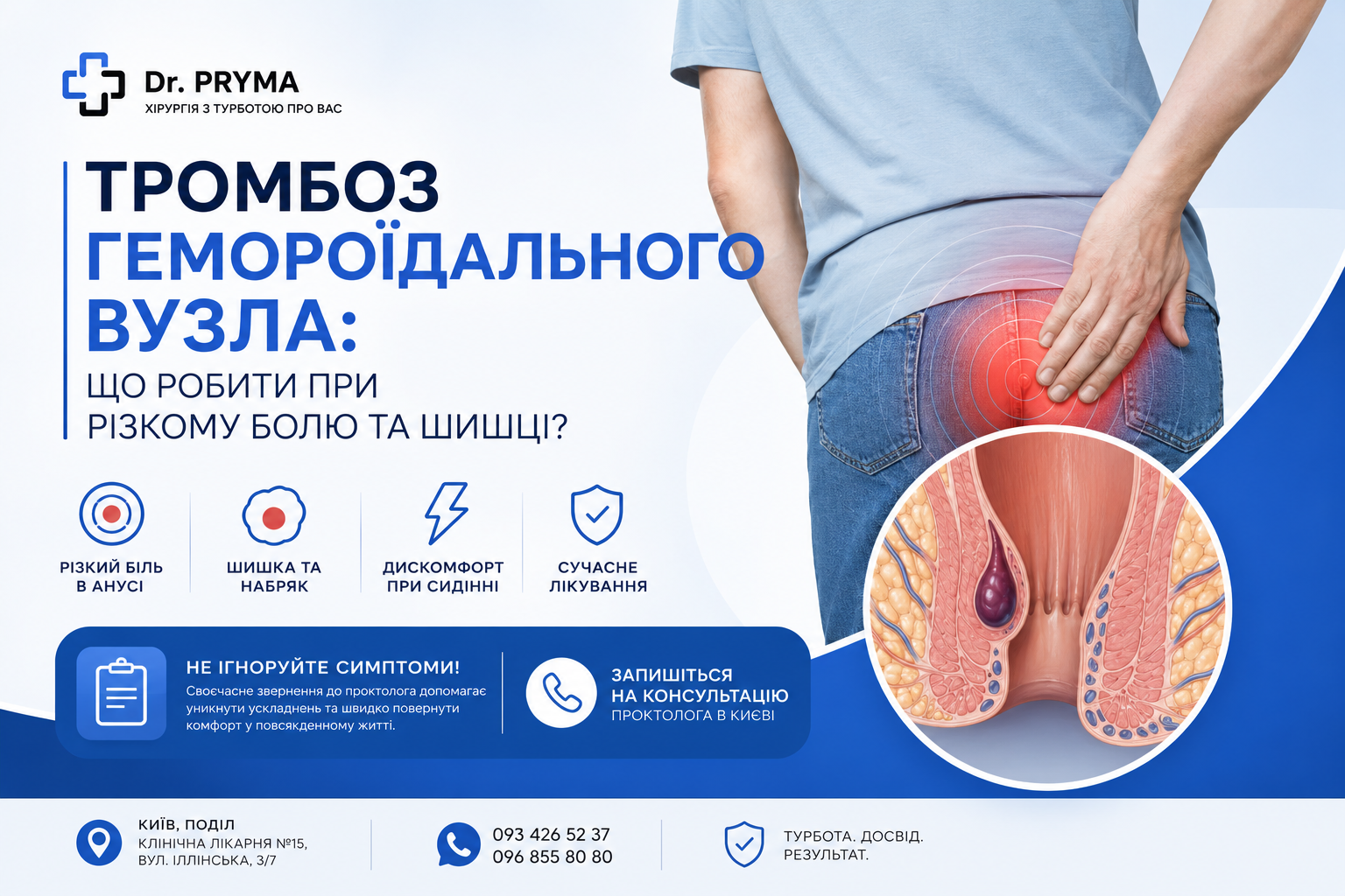 Тромбоз гемороїдального вузла: що робити при різкому болю та шишці? | Лікування в Києві