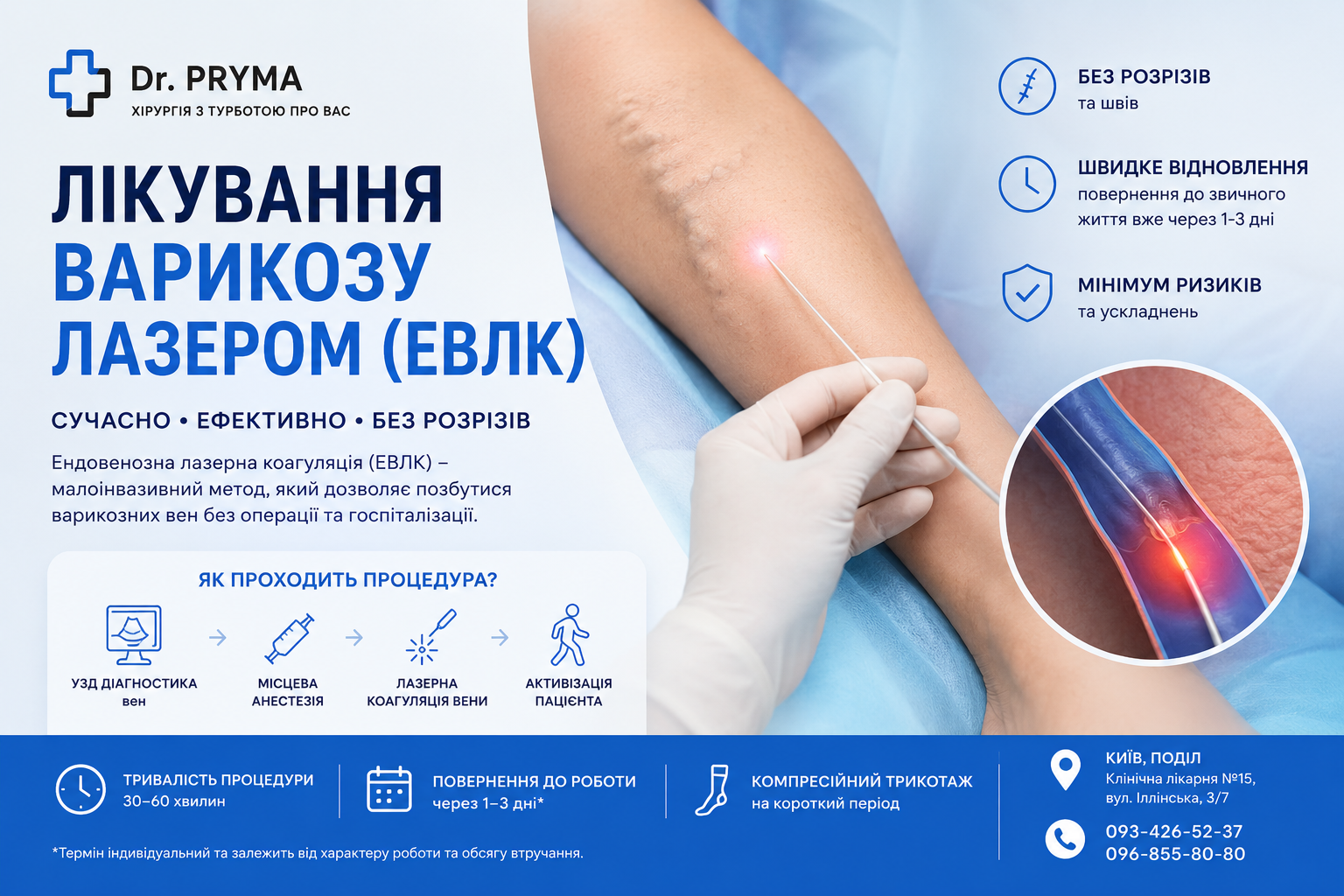 Лікування варикозу лазером — ЕВЛК у Києві | Dr. Pryma
